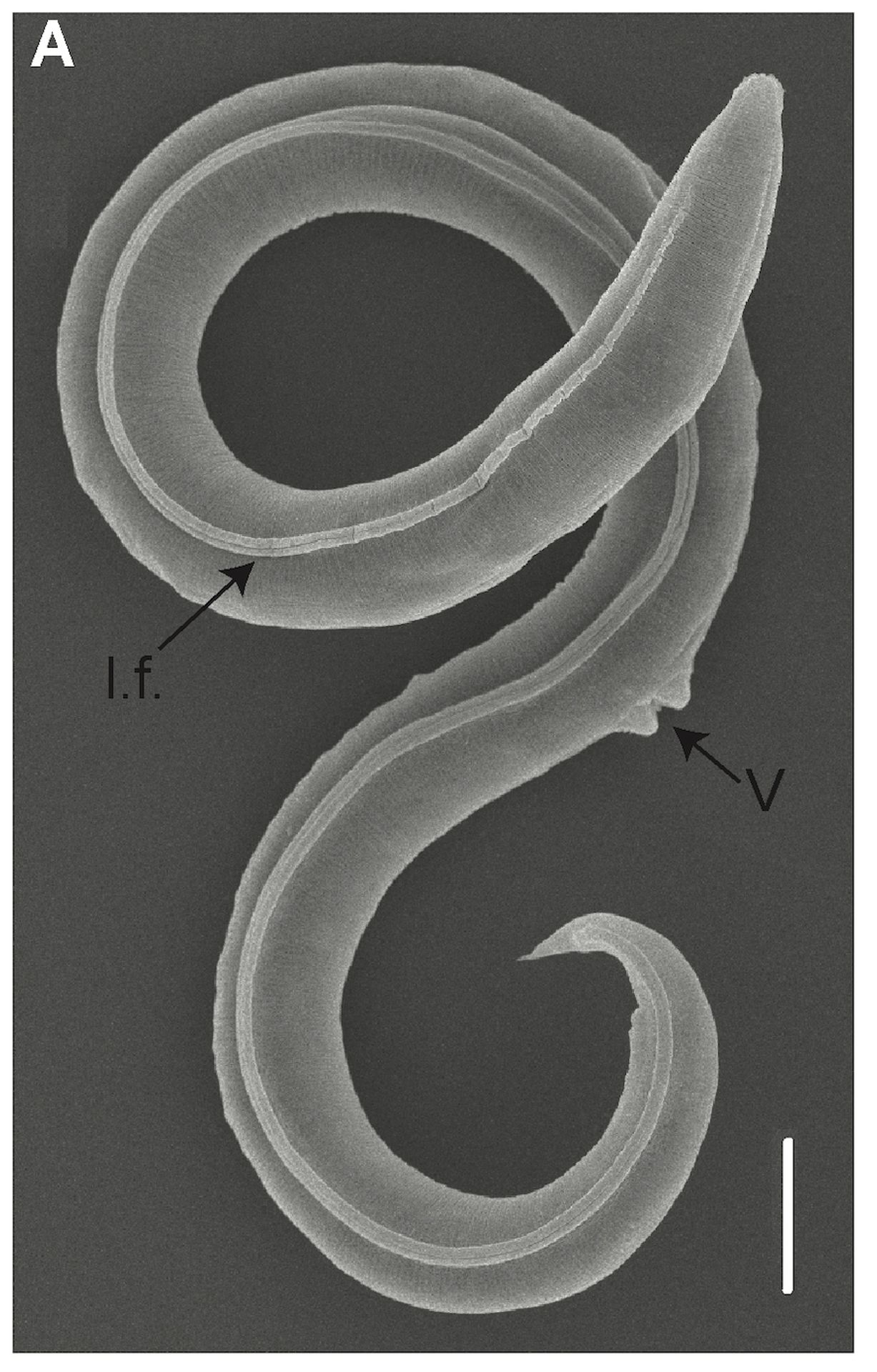 Oživené háďátko Panagrolaimus kolymaensis (1) - Oživené háďátko Panagrolaimus kolymaensis (1/6)