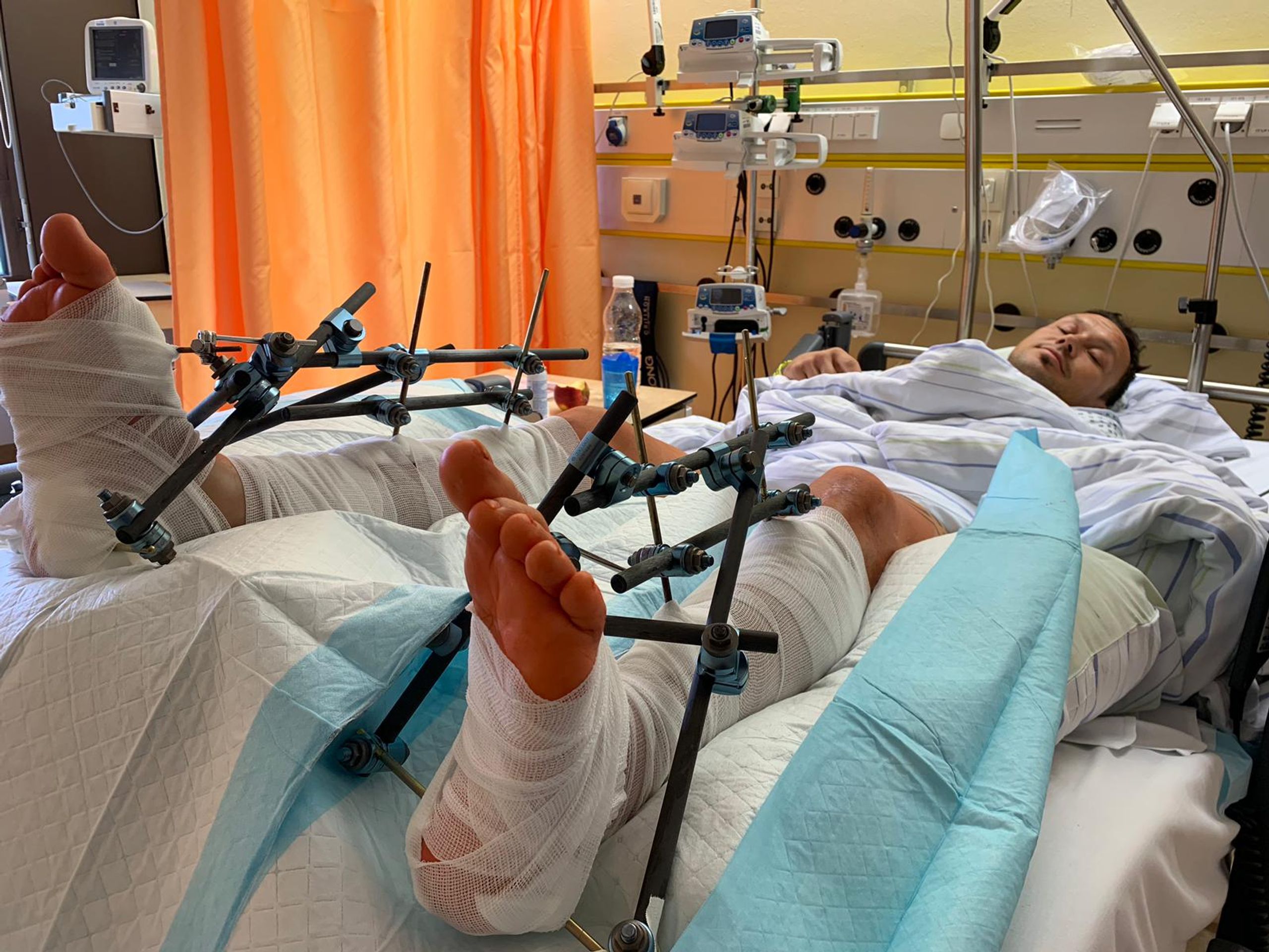 Libor Podmol v nemocnici - GALERIE: Libor Podmol si zlomil obě nohy (3/6)
