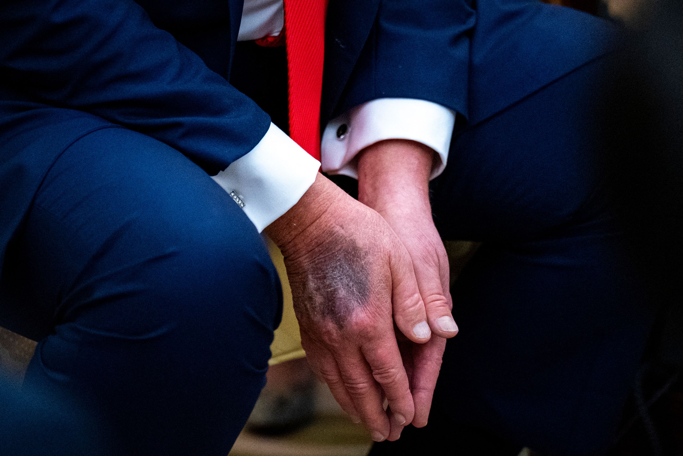 Donald Trump - Ruka Donalda Trumpa (5/5)