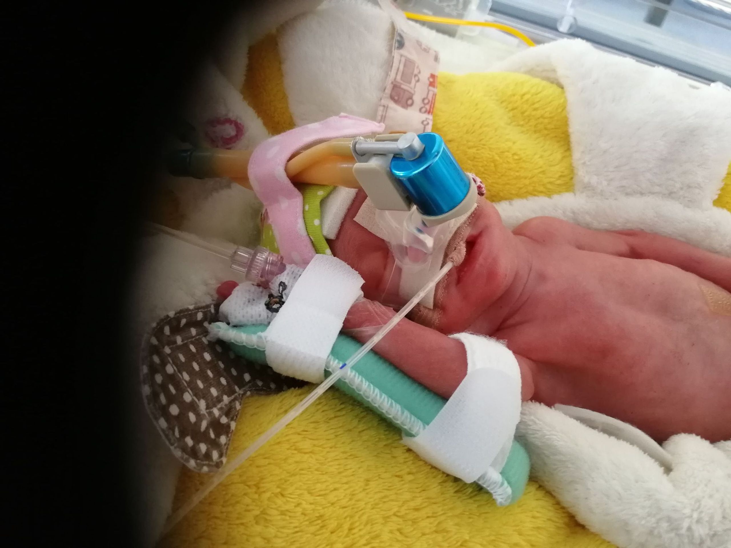Jituška po porodu vážila 650 gramů - GALERIE: Malá Jituška vážila po porodu jen 650 gramů (2/5)