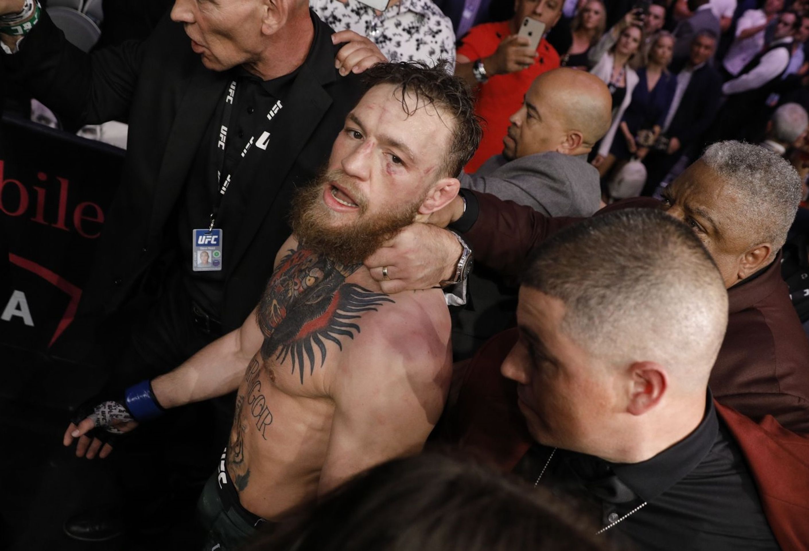 Conor McGregor - GALERIE: Takto vypadal McGregor před a po zápase s Khabibem (9/9)