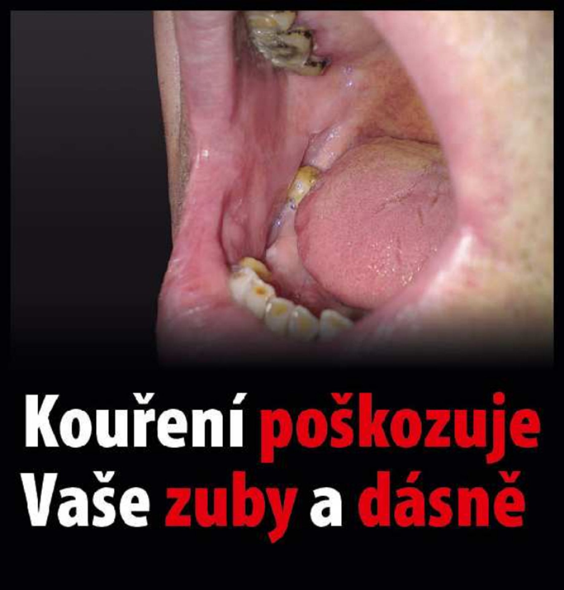 Varovné obrázky na krabičkách cigaret - 30 - GALERIE: Varovné obrázky na krabičkách cigaret (30/42)
