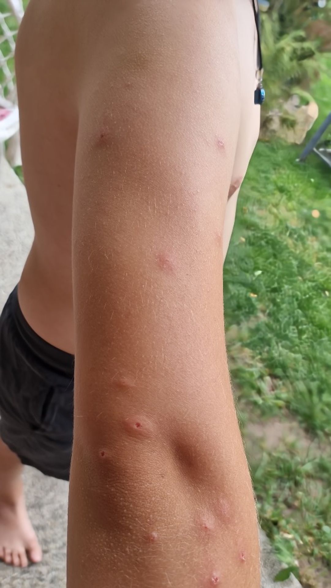 Štípance od štěnic (7) - Štípance od štěnic (9/18)