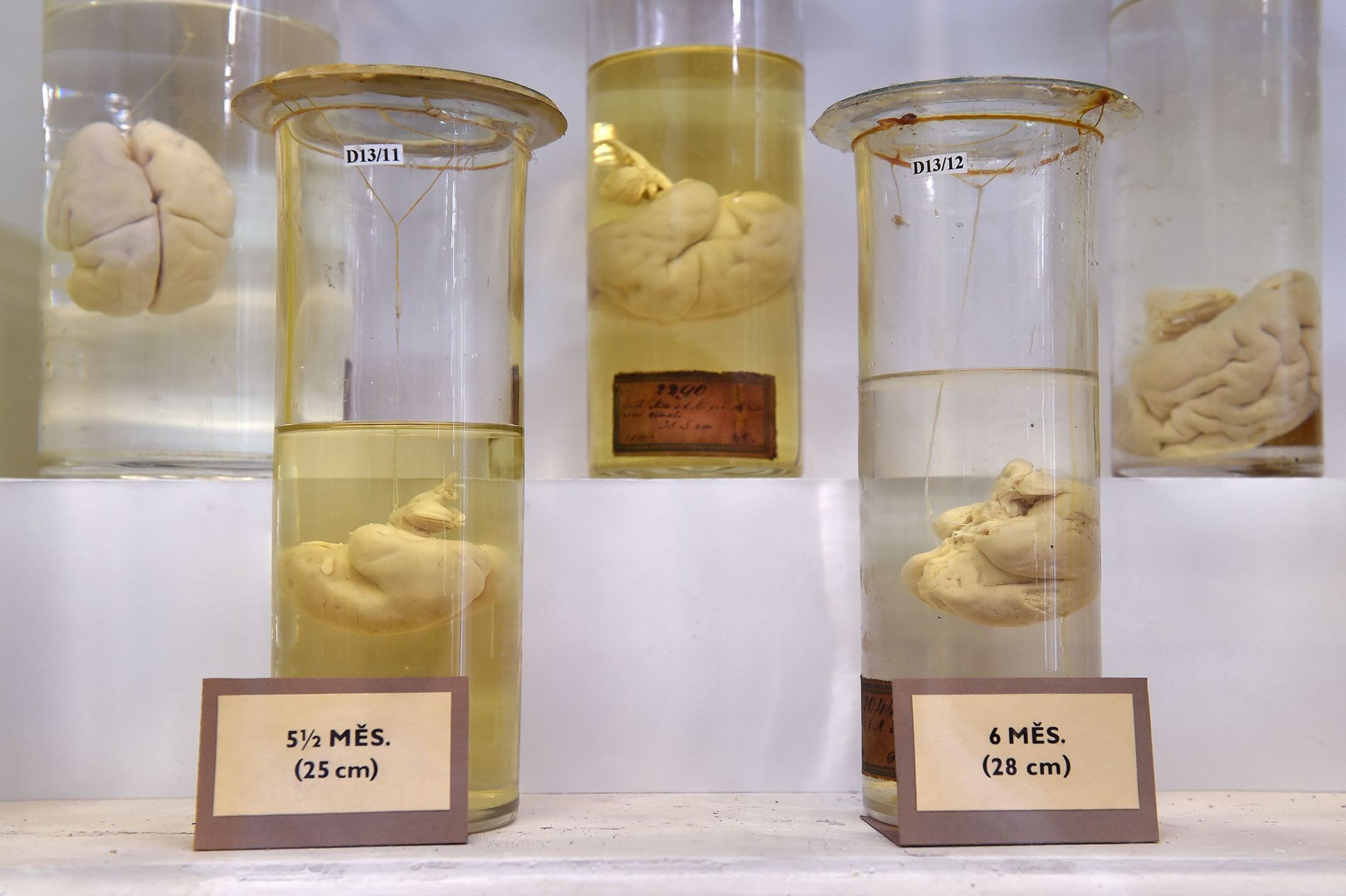 Muzeum normální a srovnávací anatomie - 10 - GALERIE: Muzeum normální a srovnávací anatomie (13/21)