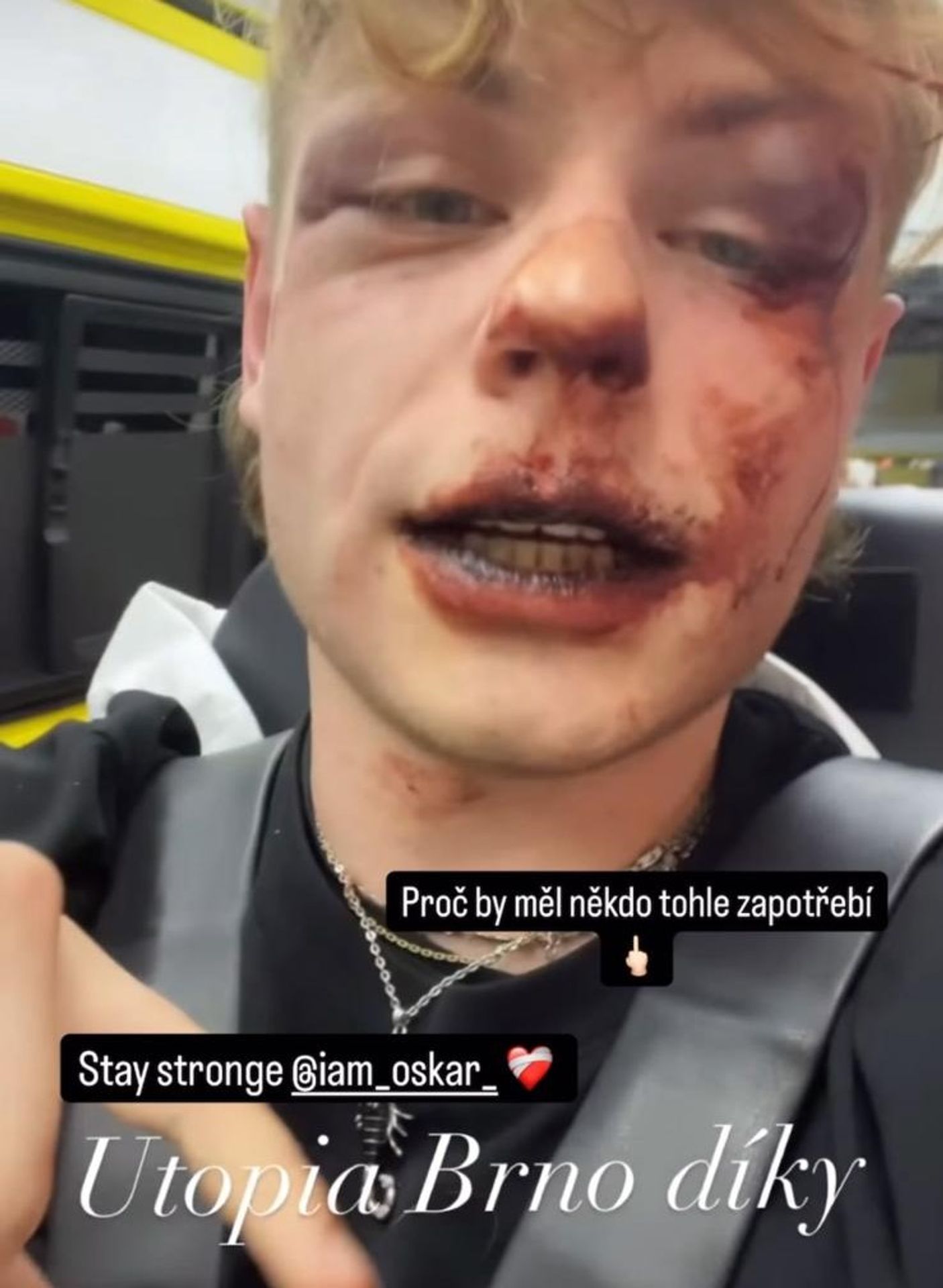 Oskar Hubáček - Oskar Hubáček po incidentu v brněnské čajovně (5/5)