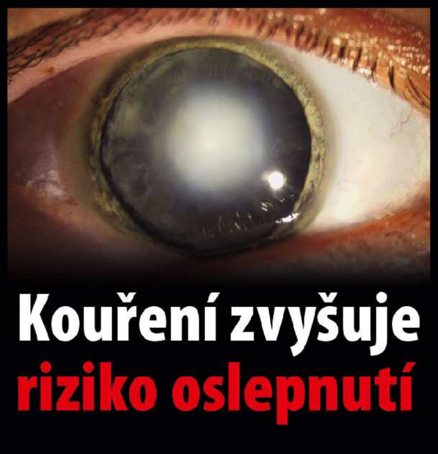Varovné obrázky na krabičkách cigaret - 40 - GALERIE: Varovné obrázky na krabičkách cigaret (40/42)