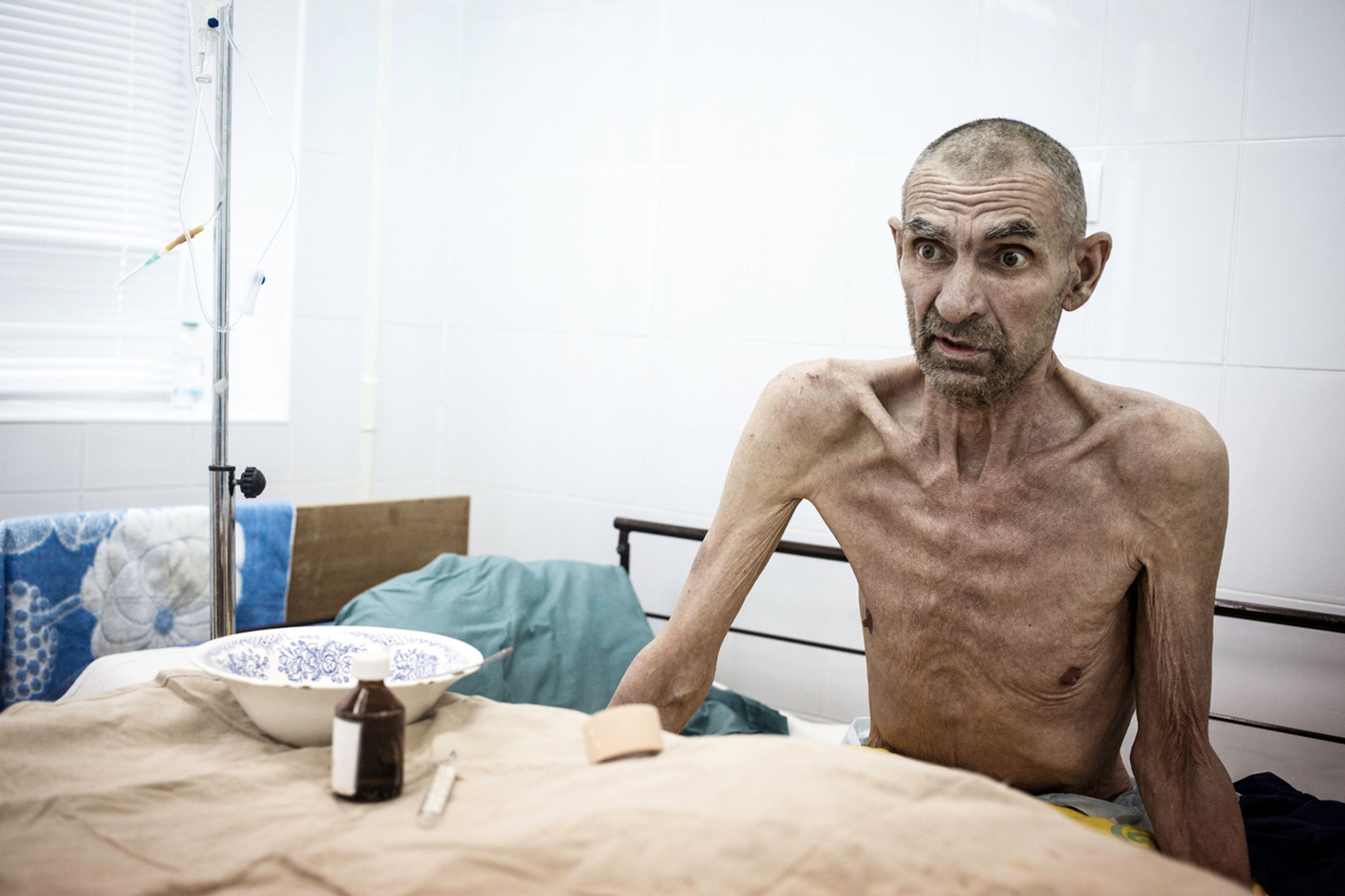 AIDS - 7 - GALERIE: AIDS (7/7)