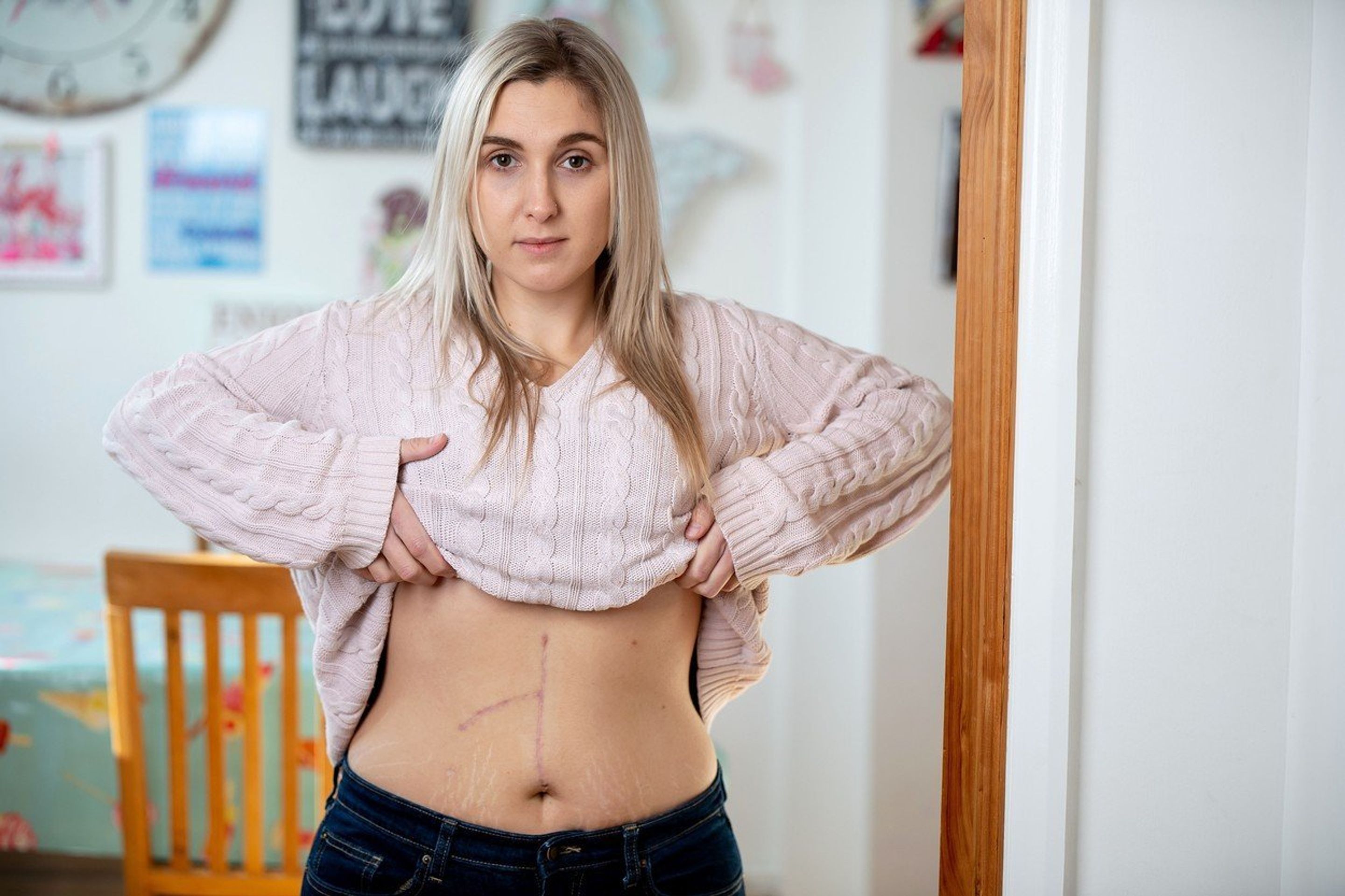 Jemma Joslyn - 1 - GALERIE: Jemma a její zranění (4/4)