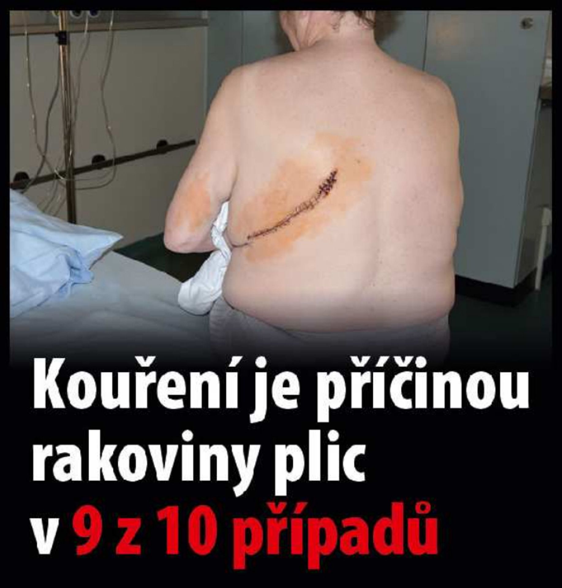 Varovné obrázky na krabičkách cigaret - 22 - GALERIE: Varovné obrázky na krabičkách cigaret (22/42)