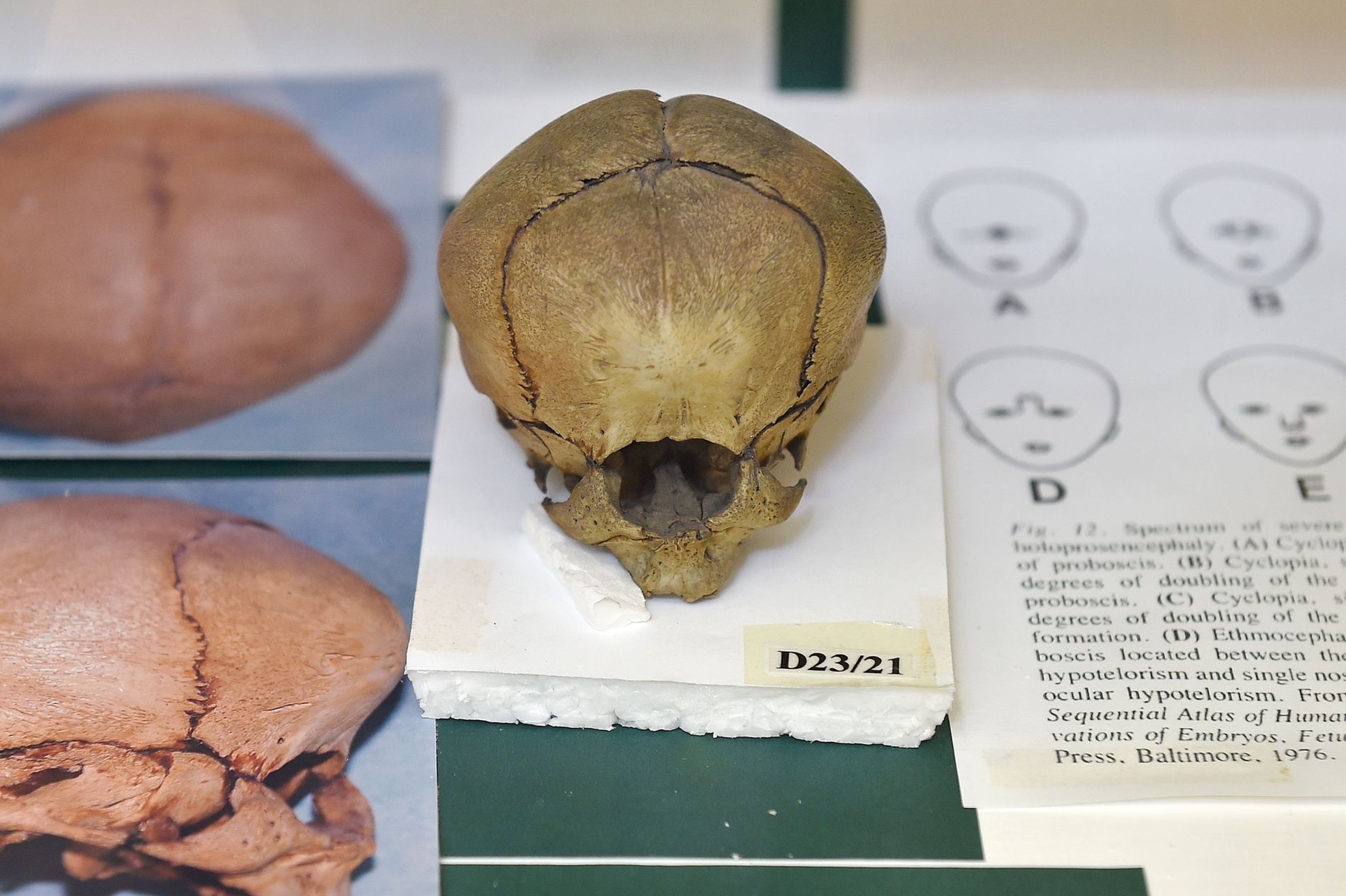 Muzeum normální a srovnávací anatomie - 3 - GALERIE: Muzeum normální a srovnávací anatomie (6/21)