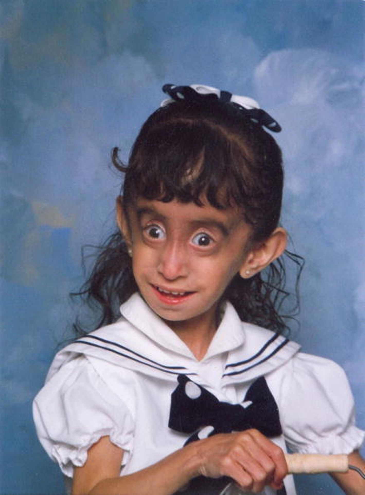 Lizzie Velasquezová - 3 - Lizzie Velasquez (6/7)