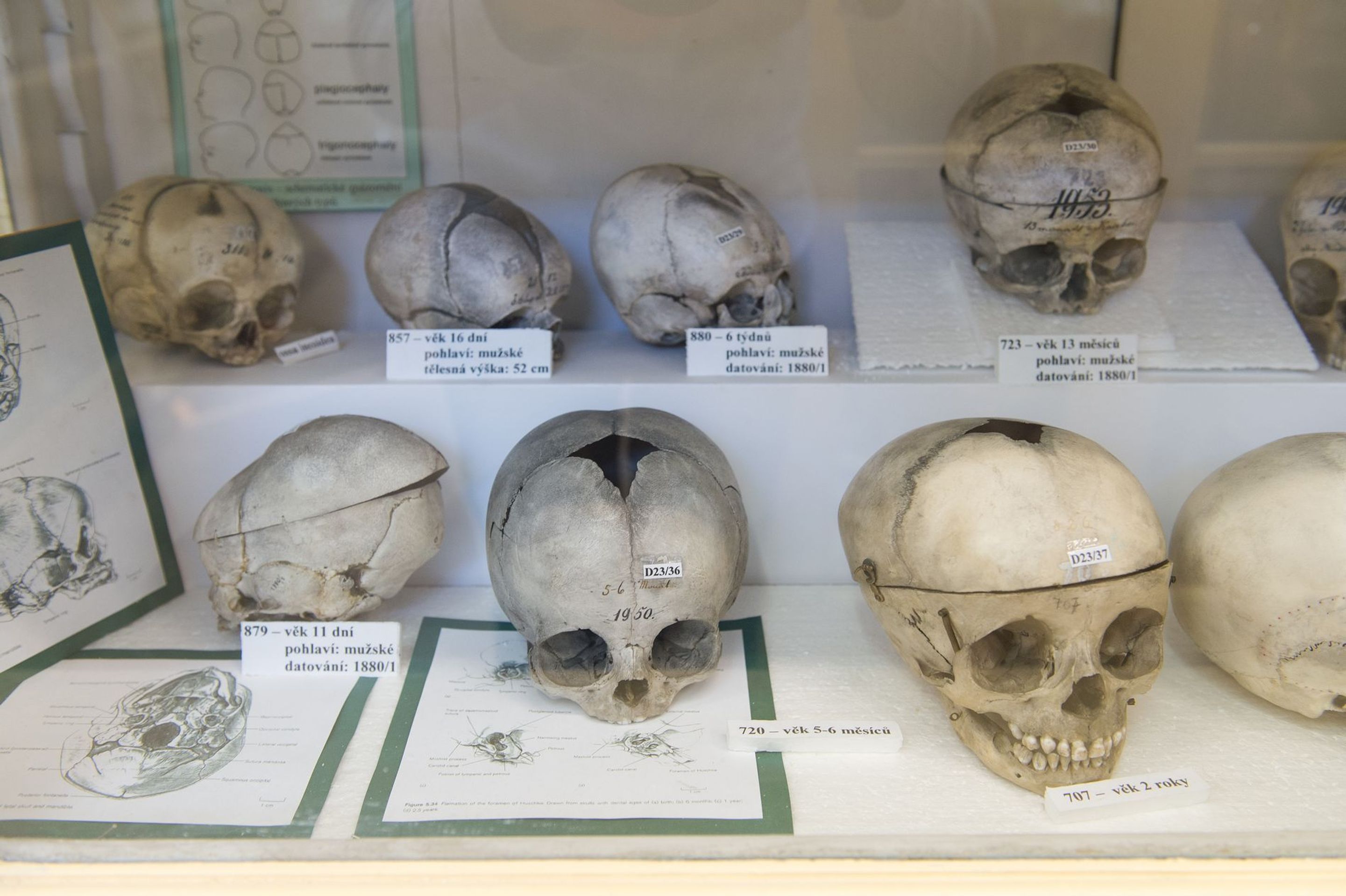 Muzeum normální a srovnávací anatomie - 5 - GALERIE: Muzeum normální a srovnávací anatomie (8/21)