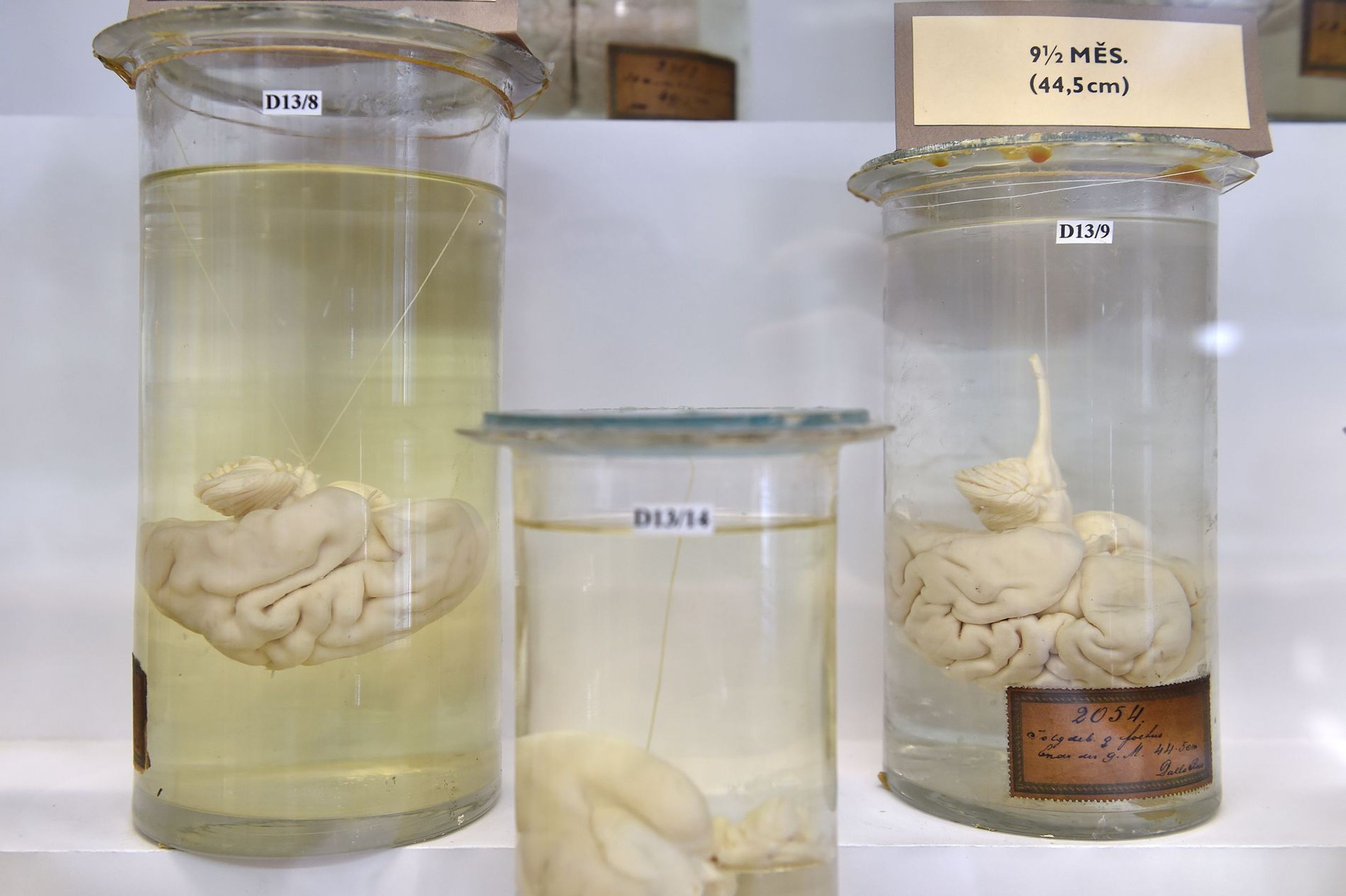 Muzeum normální a srovnávací anatomie - 11 - GALERIE: Muzeum normální a srovnávací anatomie (14/21)