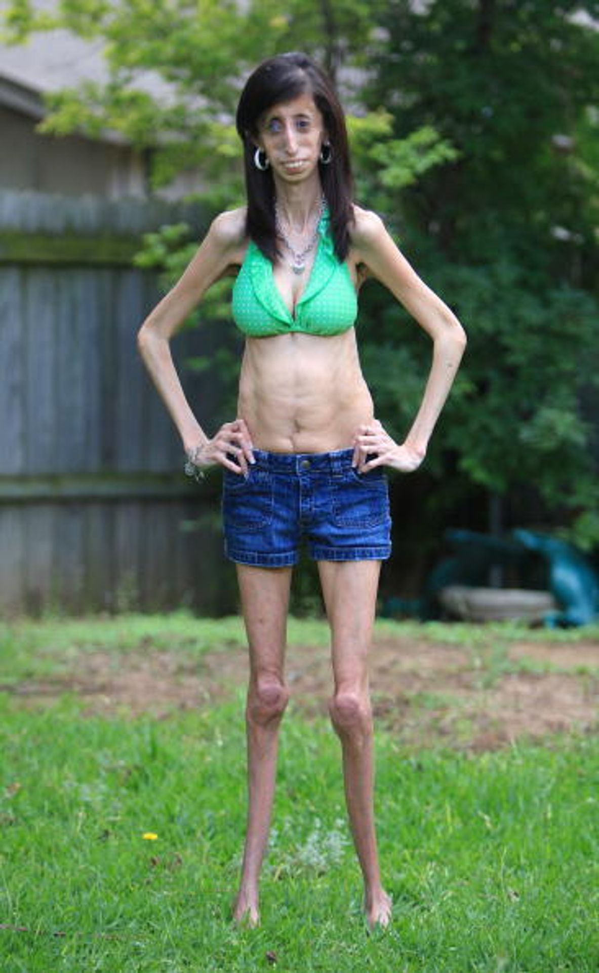 Lizzie Velasquezová - 7 - Lizzie Velasquez (4/7)