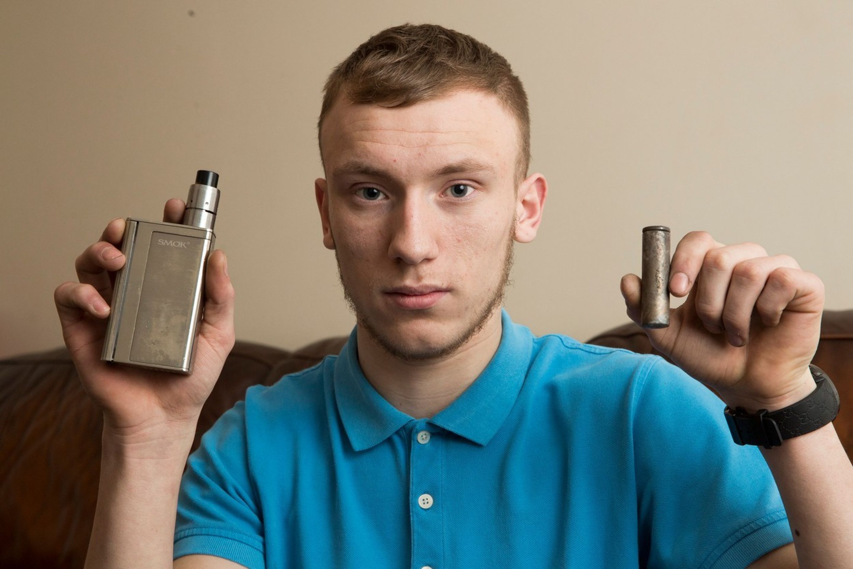 Mladíkovi se v kapse vznítila elektronická cigareta a popálila ho - 3 - GALERIE: Mladíkovi se v kapse vznítila elektronická cigareta a popálila ho (3/5)