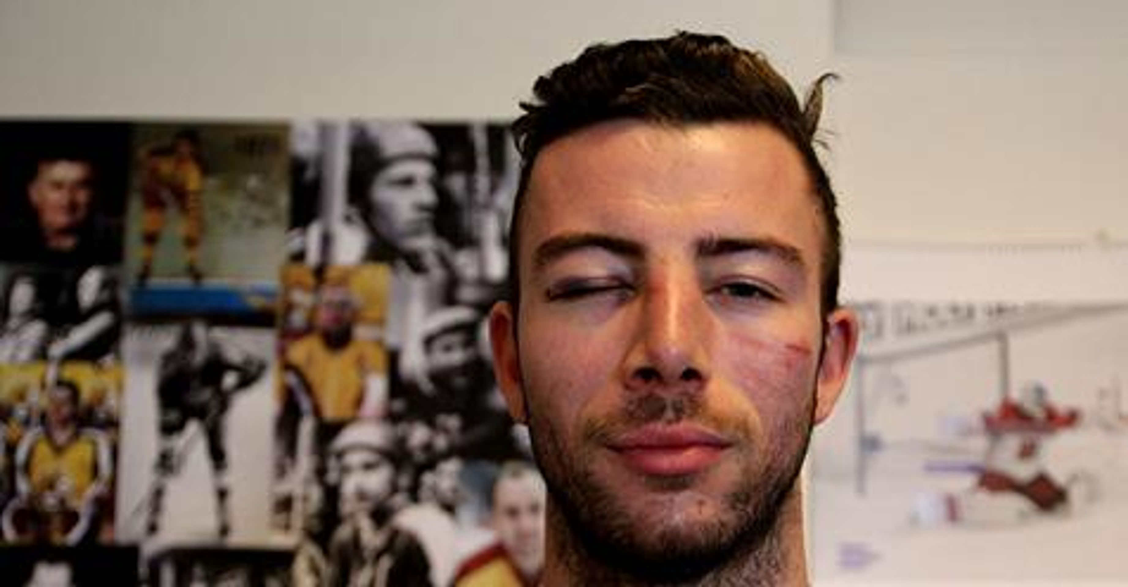 Michal Hlinka - GALERIE: Hokejista Jihlavy Michal Hlinka byl brutálně napaden (4/4)