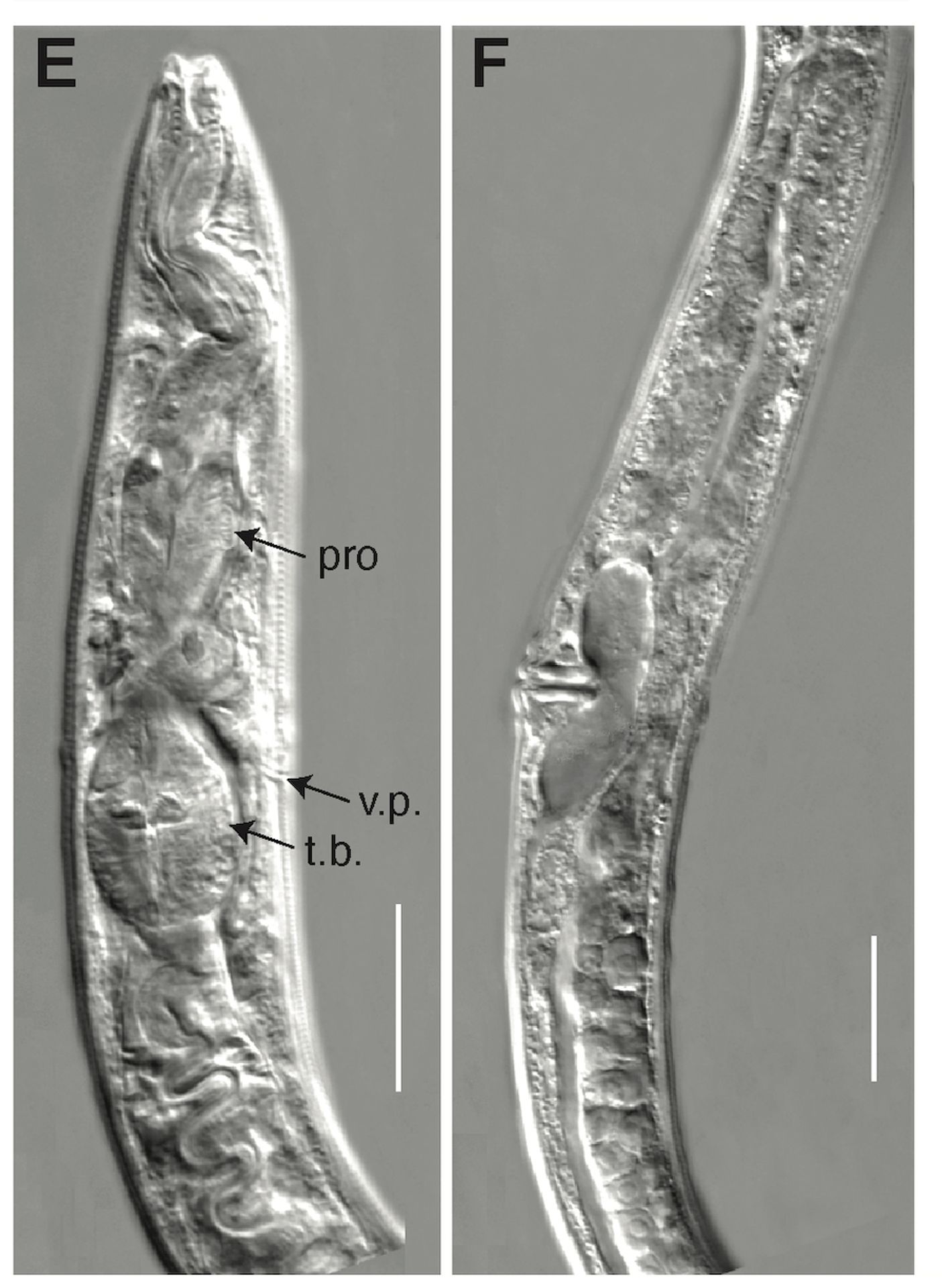 Oživené háďátko Panagrolaimus kolymaensis (5) - Oživené háďátko Panagrolaimus kolymaensis (5/6)