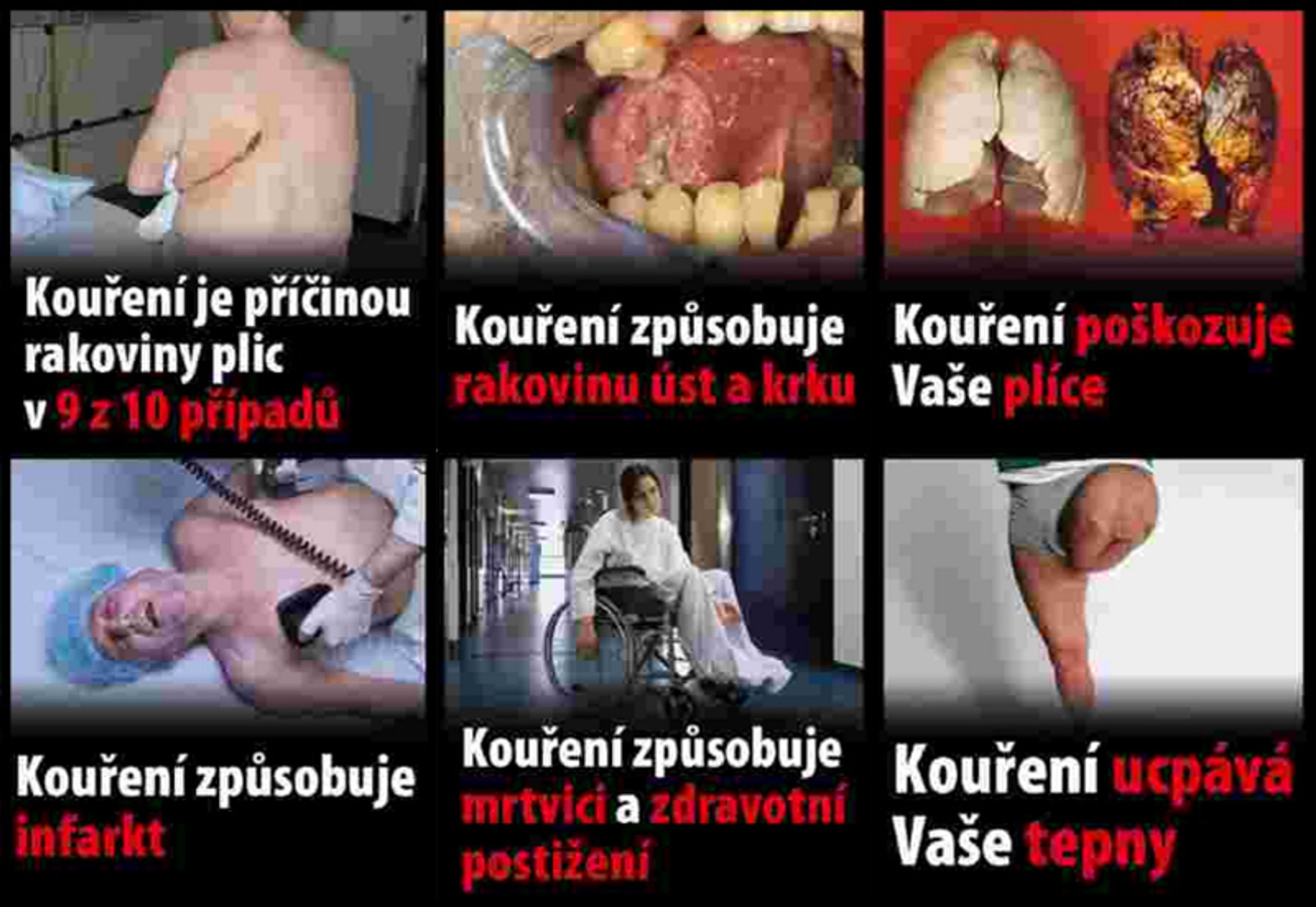 Nová varování na cigaretách - 5 - GALERIE: Nová varování na cigaretách (5/7)