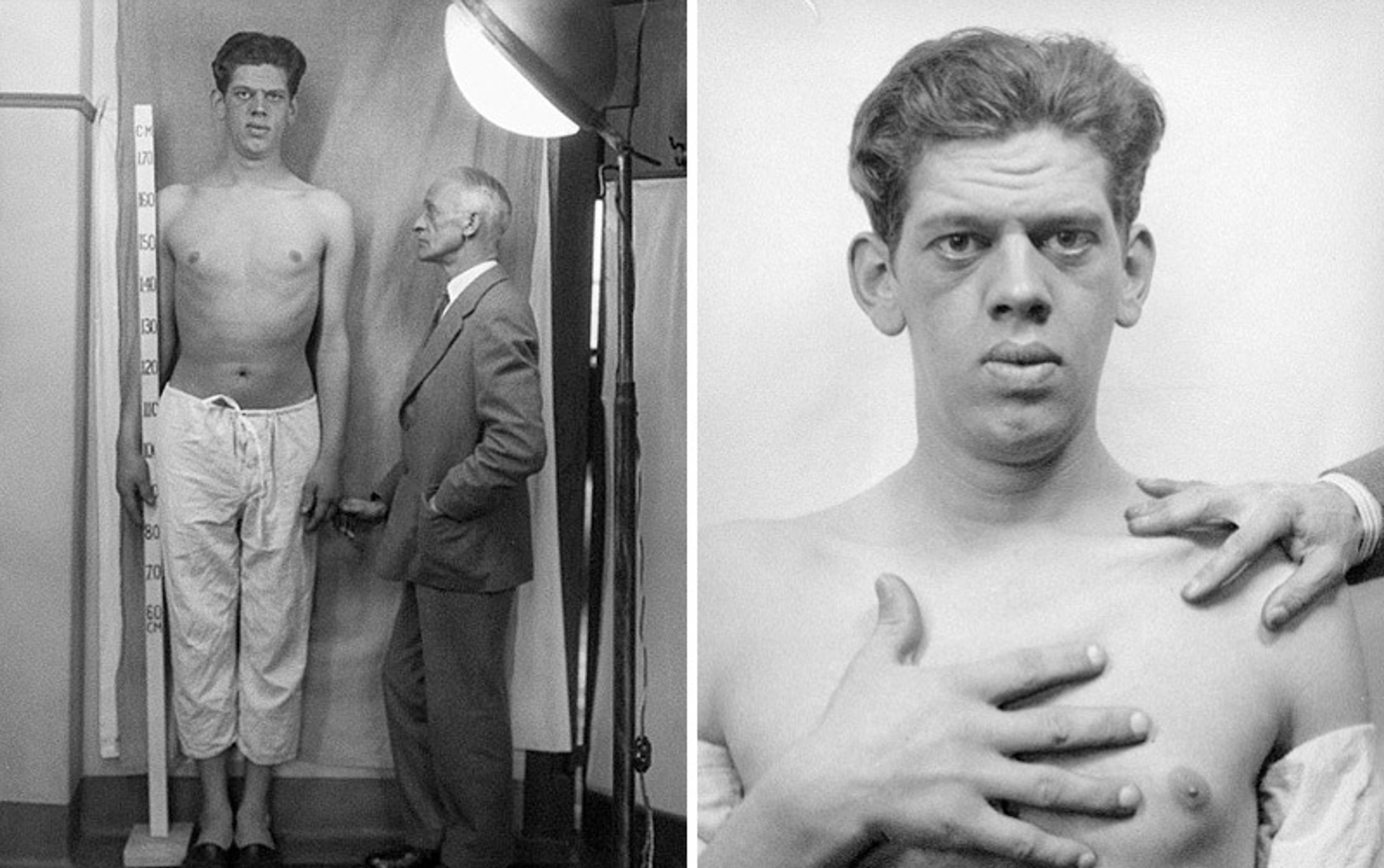 Operace mozku v historii - 7 - GALERIE: Šokující fotografie operací mozku (4/10)