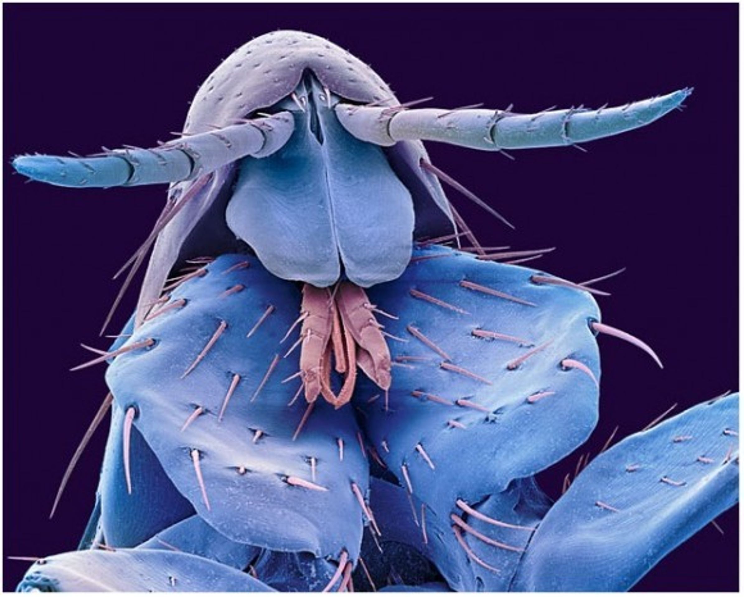Hmyz pod elektronovým mikroskopem - 14 - GALERIE: Hmyz pod elektronovým mikroskopem (8/20)