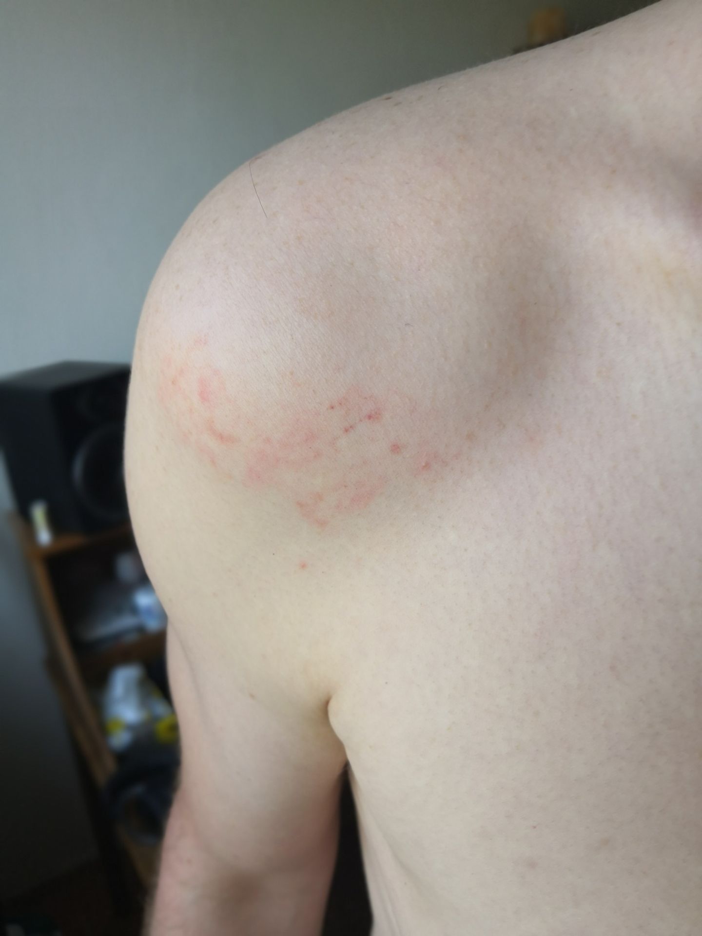 Napadení sociálního pracovníka Městskou policií - 1 - GALERIE: Údajné napadení sociálního pracovníka Městskou policií (1/4)