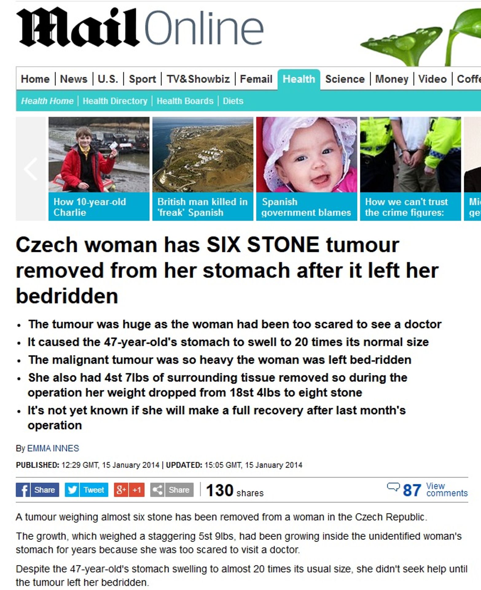 Obří nádor z Česka na DailyMailu - GALERIE: Obří nádor zaujal svět (1/4)