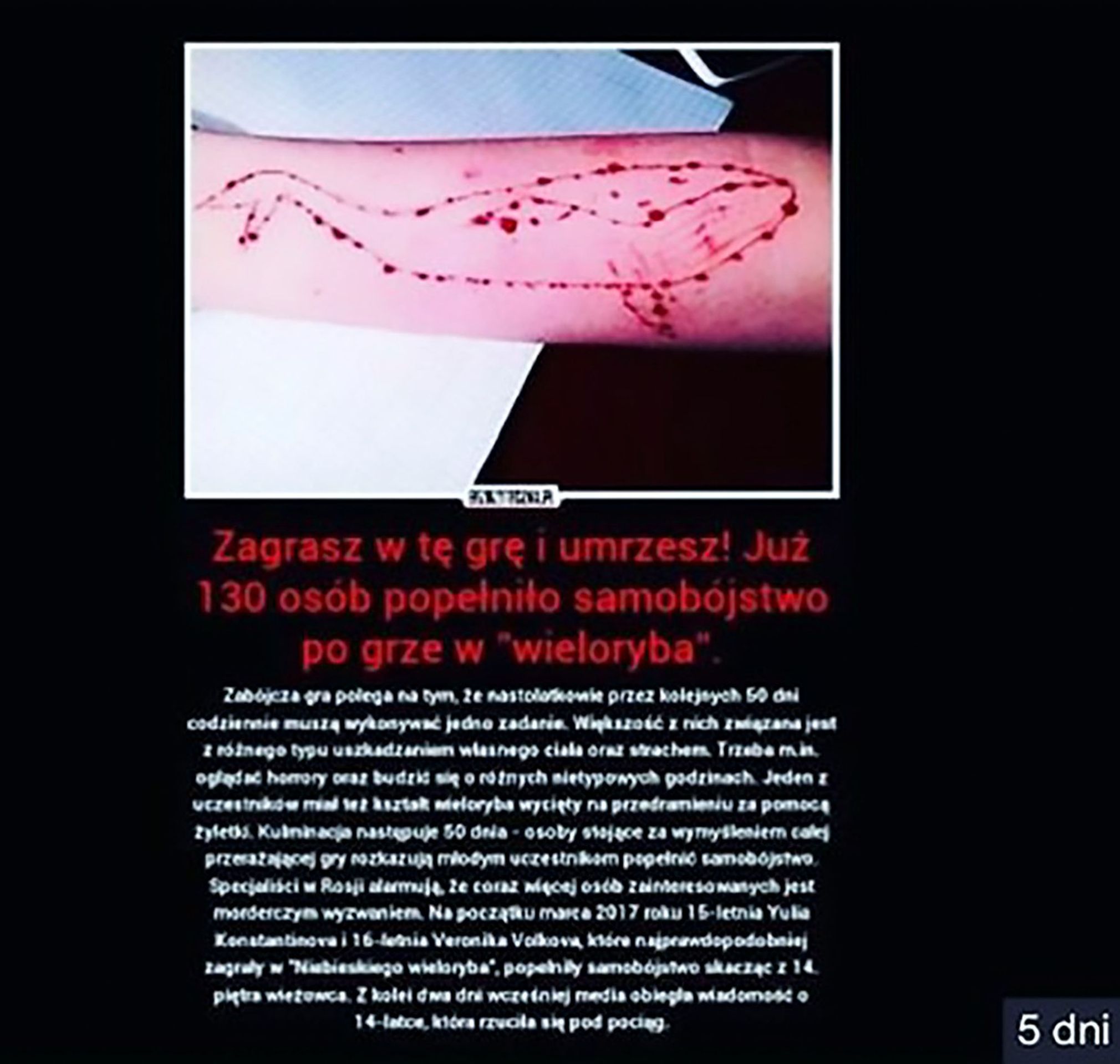 Modrá velryba - GALERIE: Děsivé hry na internetu (1/3)