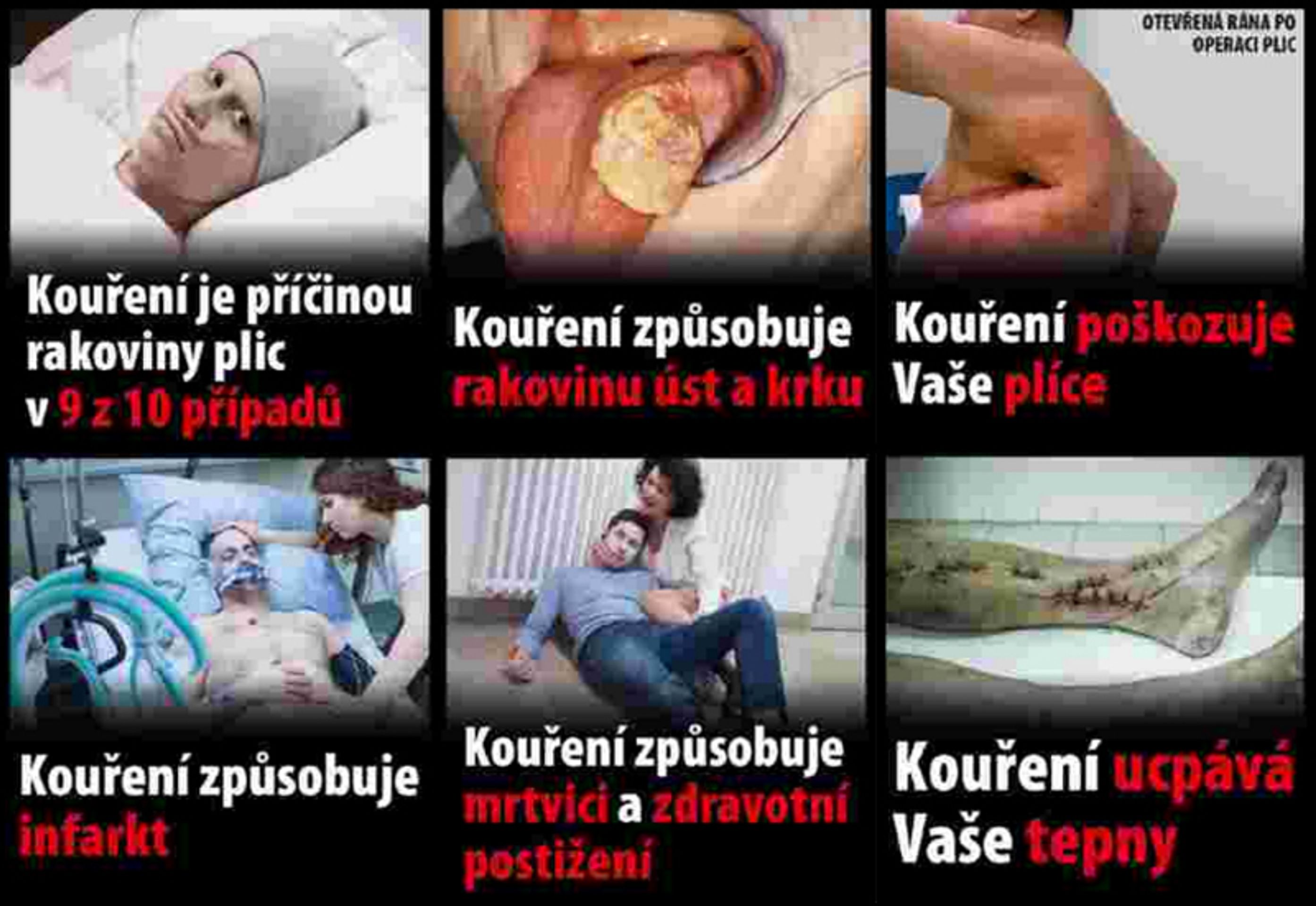 Nová varování na cigaretách - 3 - GALERIE: Nová varování na cigaretách (3/7)