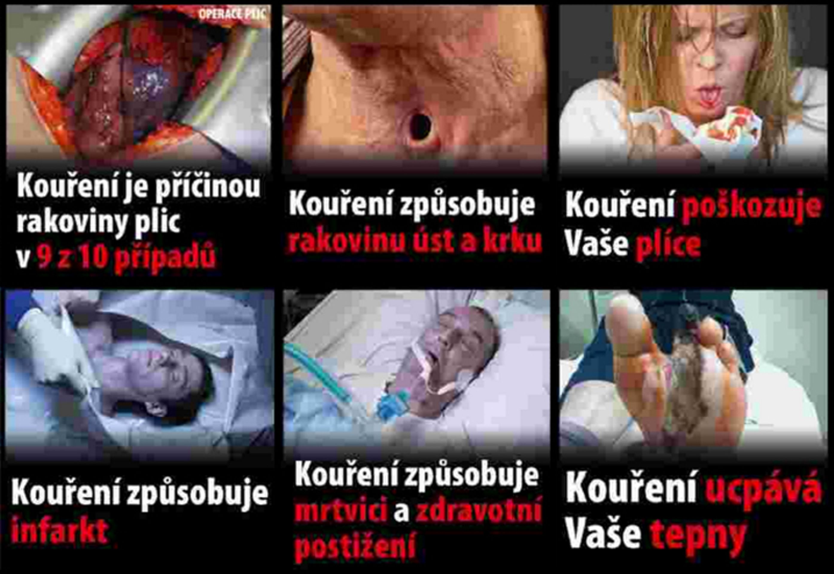 Nová varování na cigaretách - 1 - GALERIE: Nová varování na cigaretách (1/7)