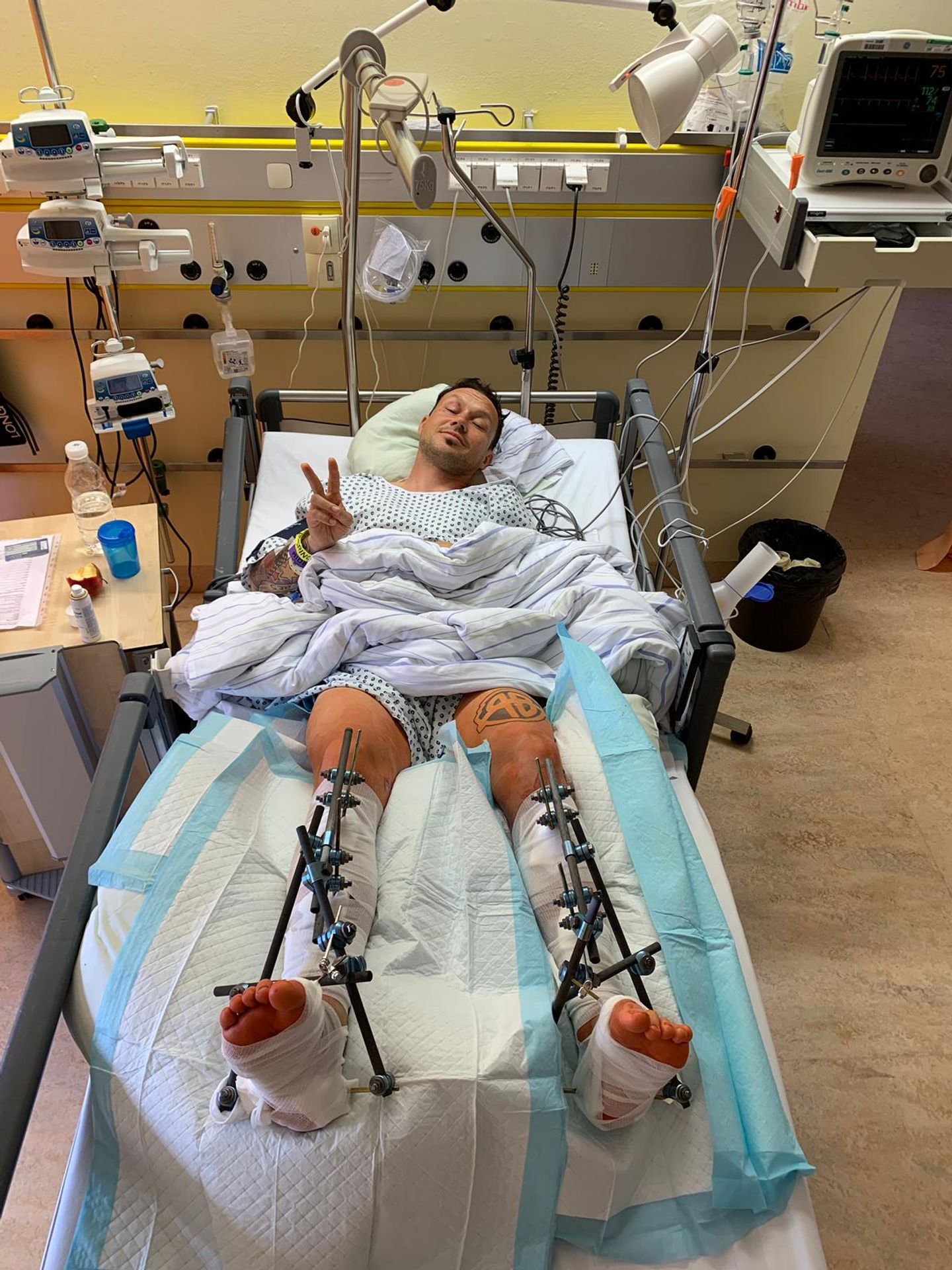 Libor Podmol v nemocnici - GALERIE: Libor Podmol si zlomil obě nohy (4/6)