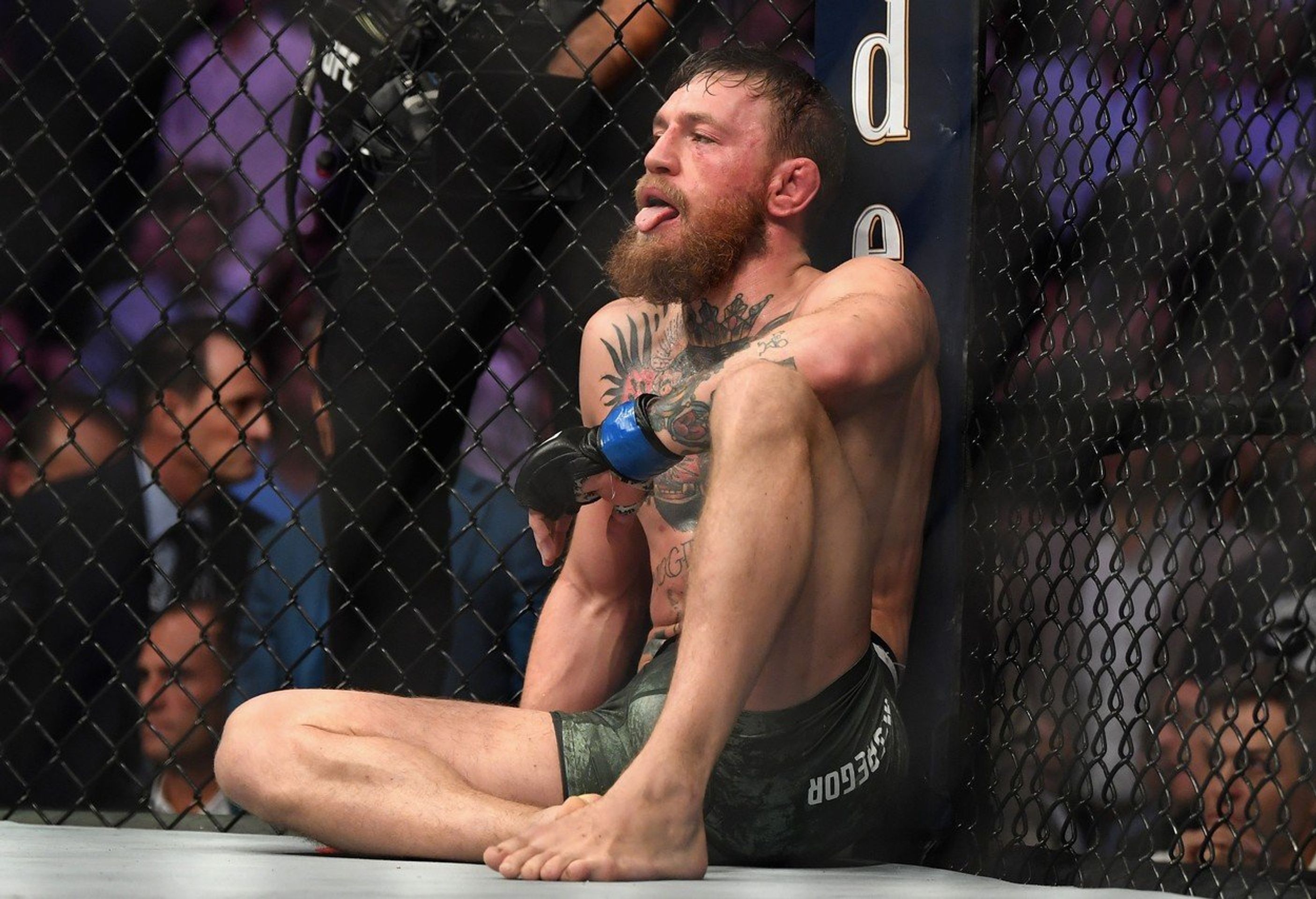 Conor McGregor - GALERIE: Takto vypadal McGregor před a po zápase s Khabibem (8/9)