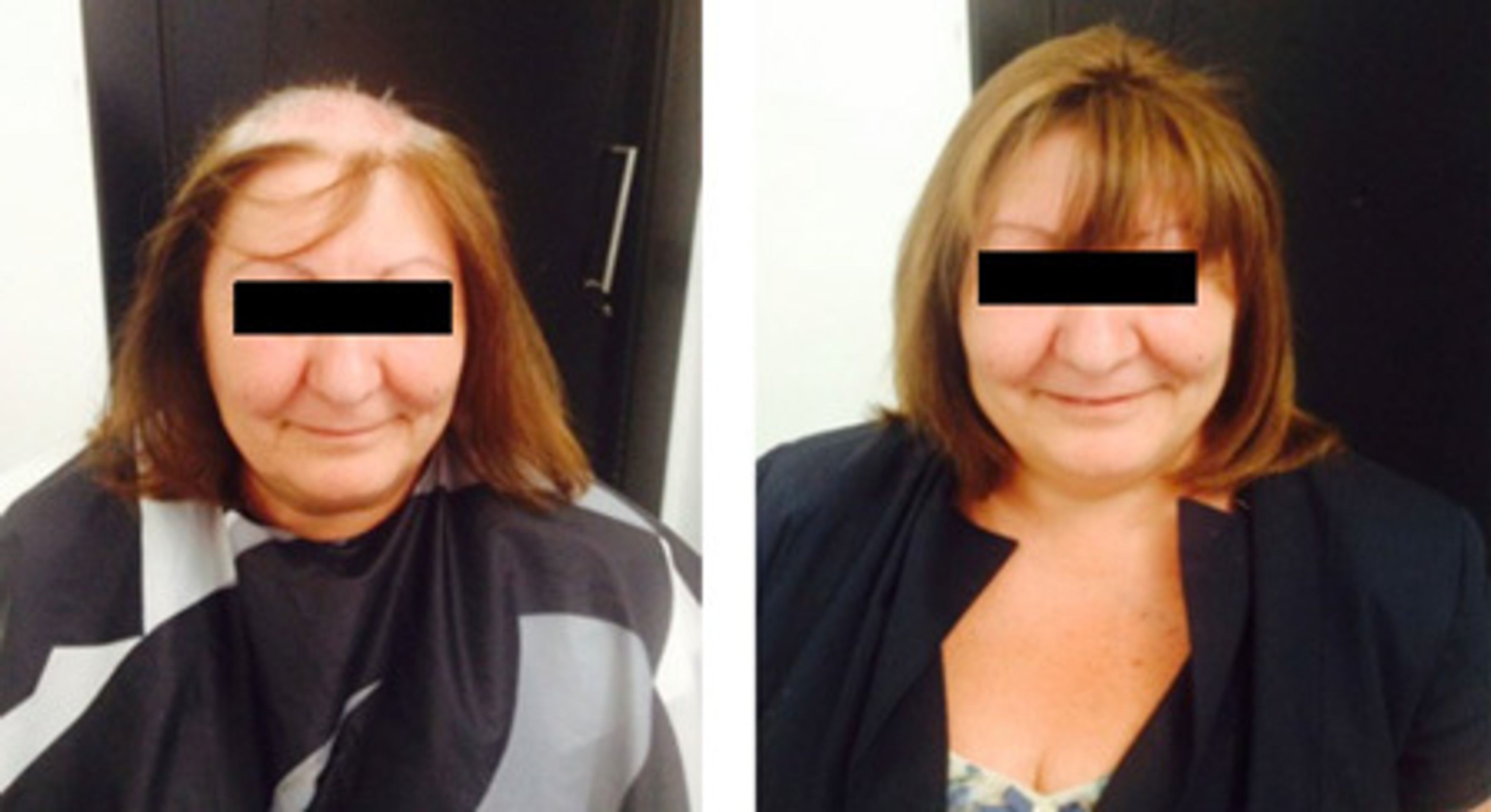 Vlasy - Před a po - 4 - GALERIE: Vlasy (4/4)