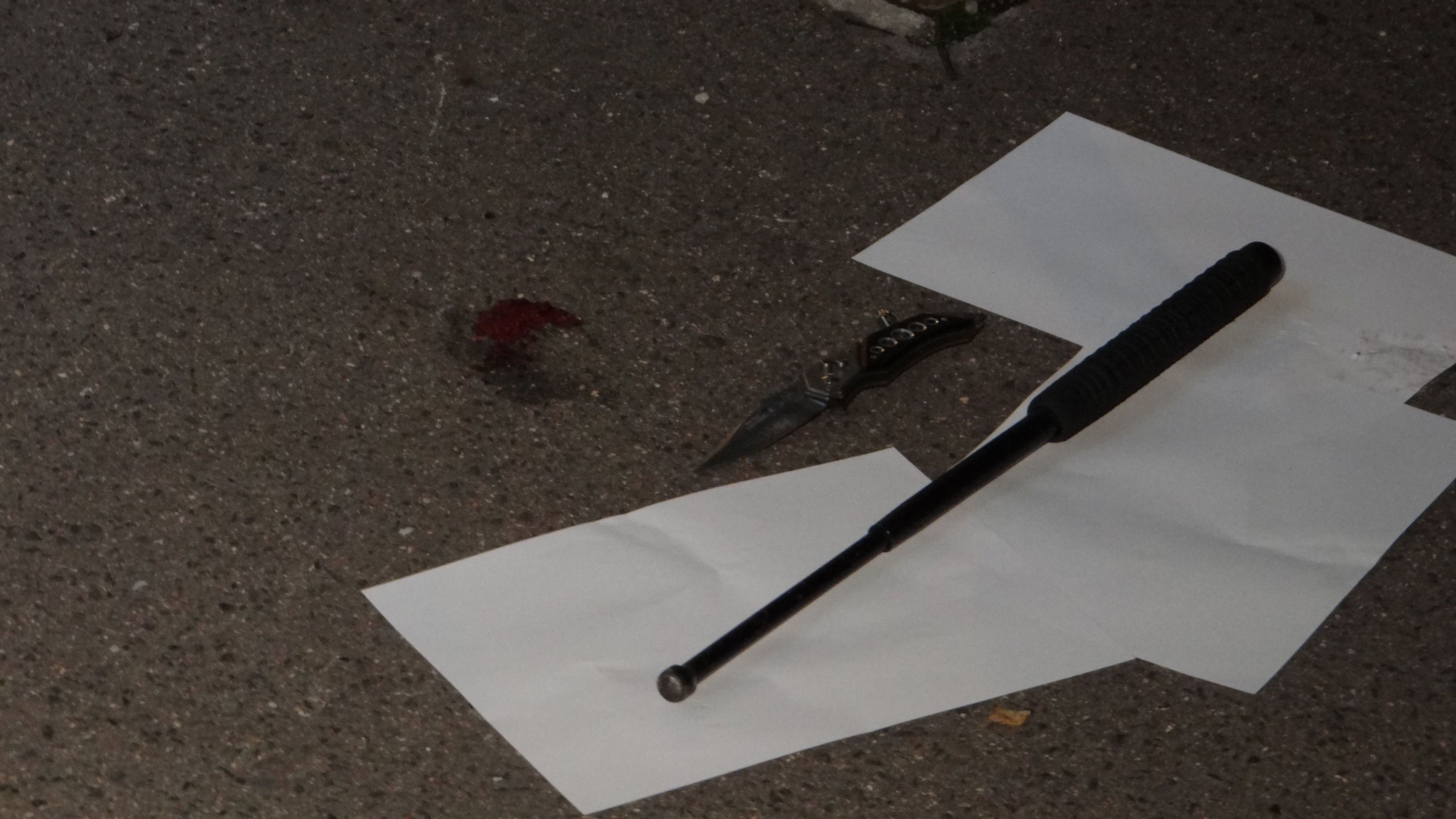 Policistům a strážníkům se venku před záchytkou podařilo agresora odzbrojit a zkrotit - GALERIE: Muž s nožem napadl na záchytce policisty (2/4)