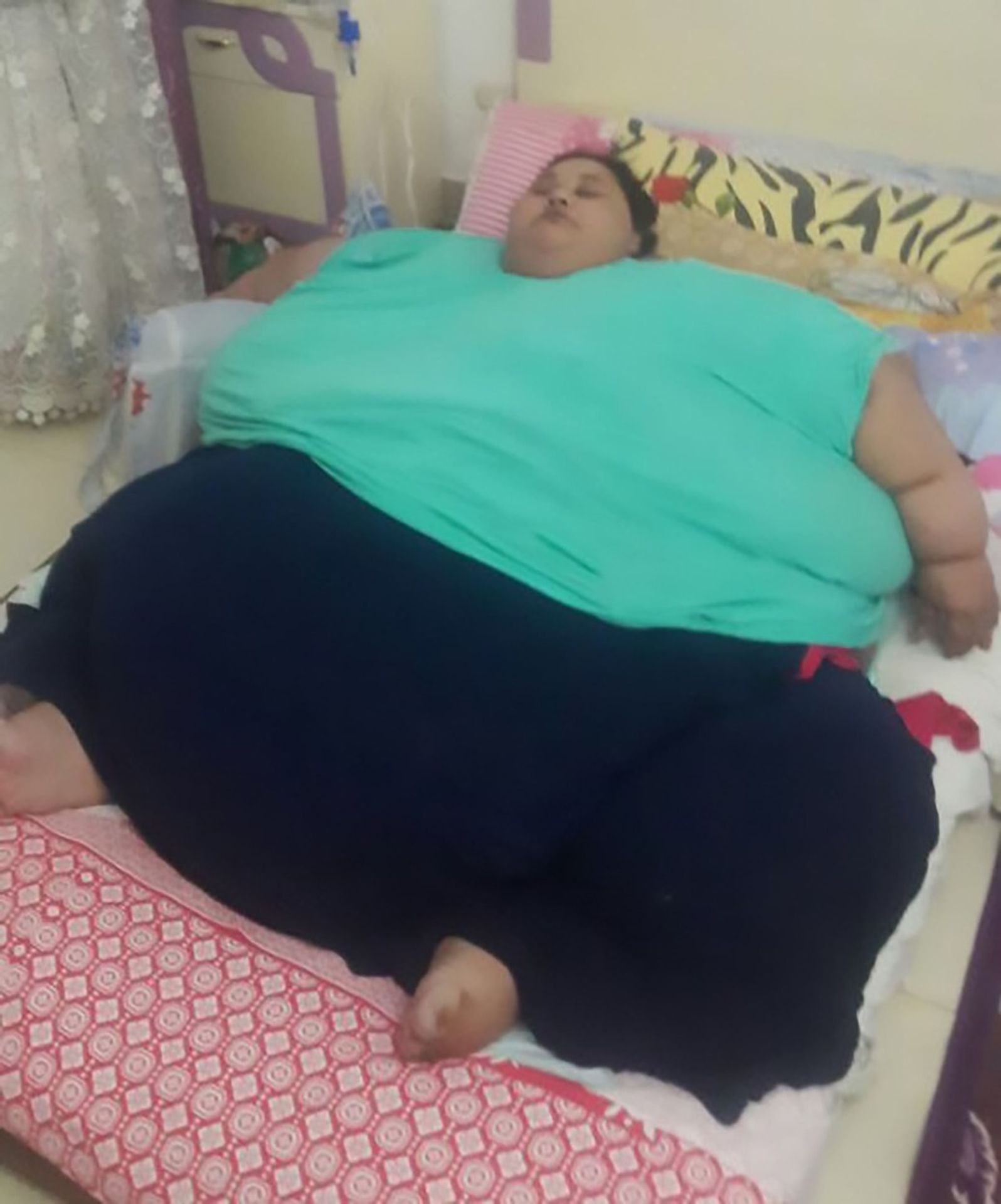 Ženu, která váží 500 kg čeká operace - GALERIE: Iman Ahmad Abdulati (3/5)