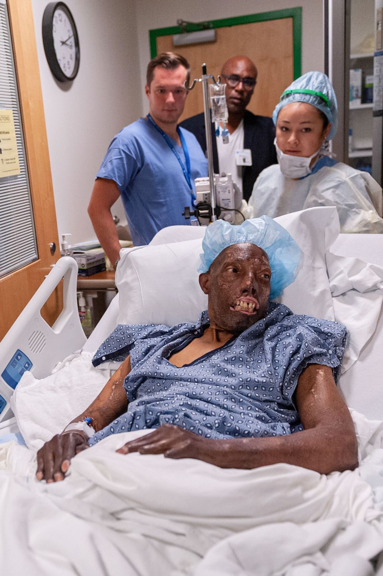 Transplantace obličeje Afroameričanovi - 1 - GALERIE: Transplantace obličeje prvnímu Afroameričanovi (2/5)