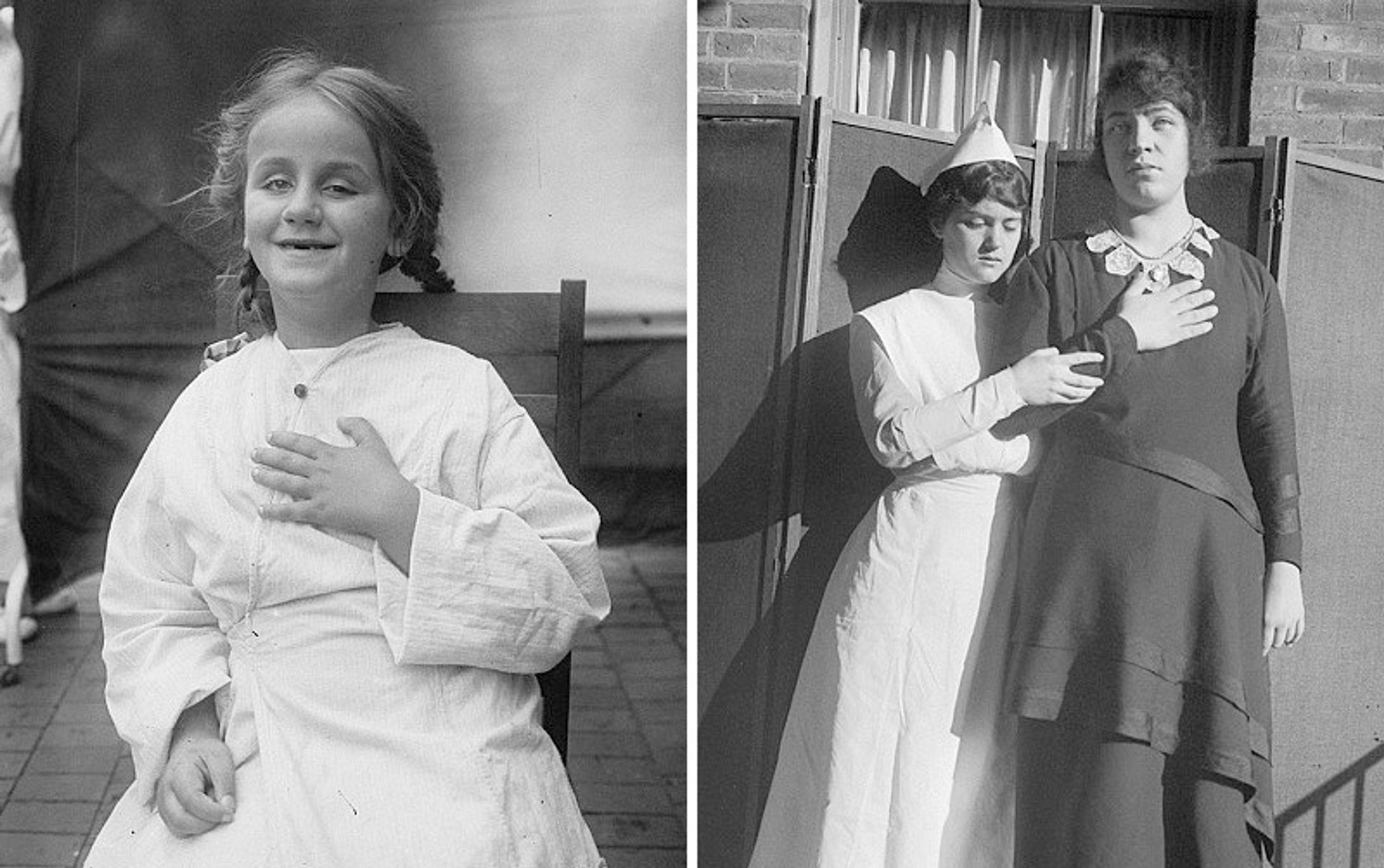 Operace mozku v historii - 10 - GALERIE: Šokující fotografie operací mozku (7/10)