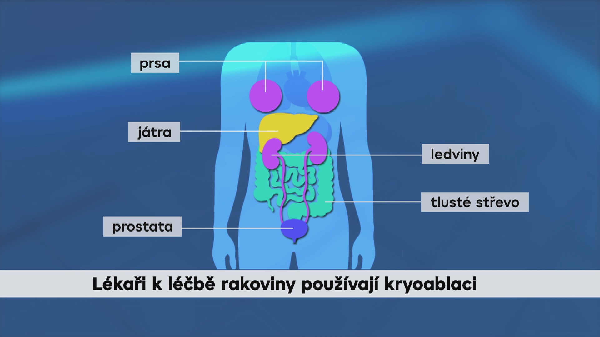 Rakovina grafika