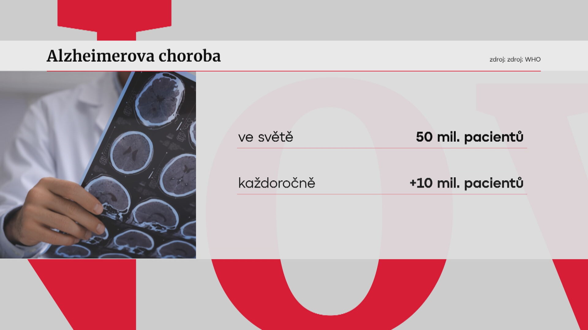 Alzheimerova choroba